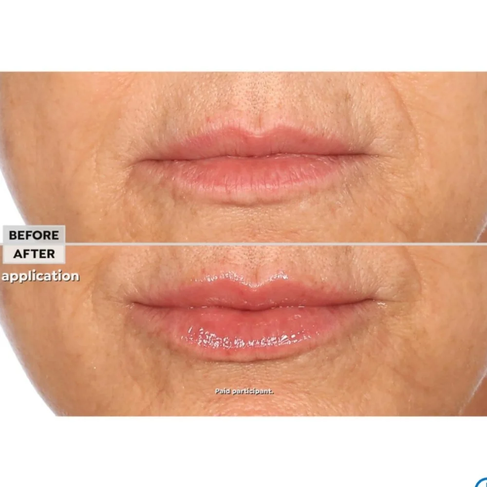 Nakery Beauty Lip Plumping And Line Treatment Full‎ Size